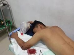 Apes! Subuh-Subuh Disergap Begal, Dua Remaja di Cabangbungin Jadi Korban