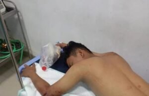 Apes! Subuh-Subuh Disergap Begal, Dua Remaja di Cabangbungin Jadi Korban